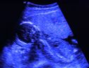 UltrasoundCaptureSmall